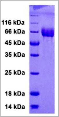 product-image-AAA13744_SDS_PAGE.jpg