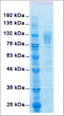 product-image-AAA13751_SDS_PAGE.jpg