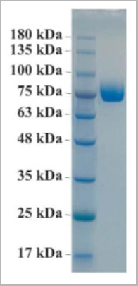 product-image-AAA13763_SDS_PAGE.jpg