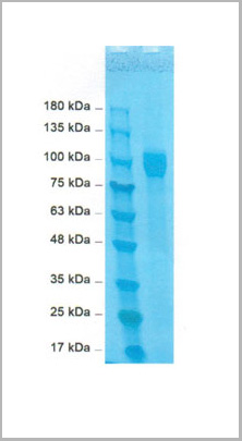 product-image-AAA13769_SDS_PAGE.jpg