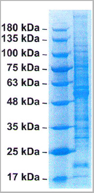 product-image-AAA13772_SDS_PAGE.jpg