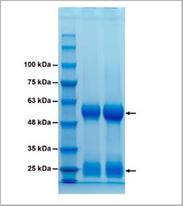 product-image-AAA13777_SDS_PAGE2.jpg