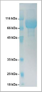 product-image-AAA13781_SDS_PAGE.jpg