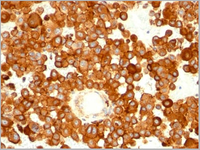 product-image-AAA13803_IHC.jpg