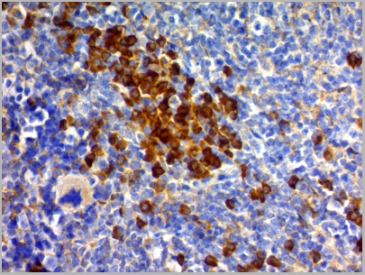 product-image-AAA13803_IHC2.jpg