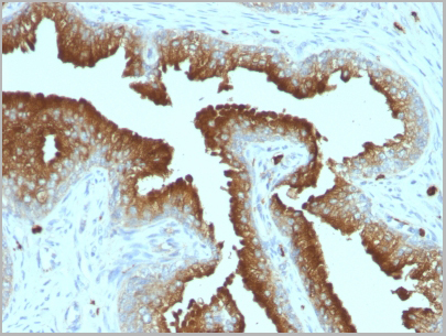 product-image-AAA13803_IHC3.jpg