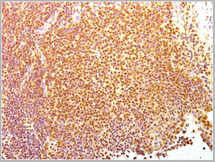 product-image-AAA13804_IHC3.jpg