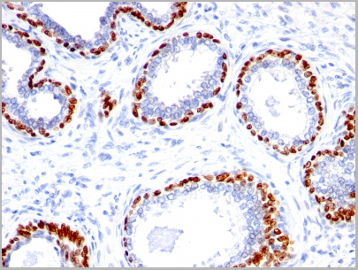 product-image-AAA13805_IHC.jpg