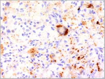 product-image-AAA13806_IHC.jpg
