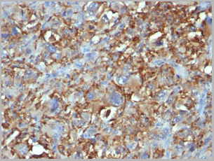 product-image-AAA13807_IHC.jpg