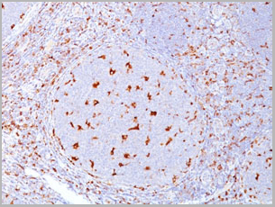 product-image-AAA13807_IHC2.jpg