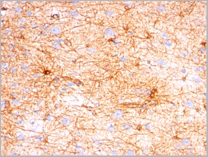 product-image-AAA13808_IHC.jpg