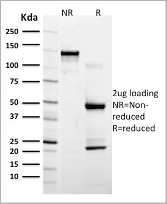 product-image-AAA13808_SDS_PAGE3.jpg
