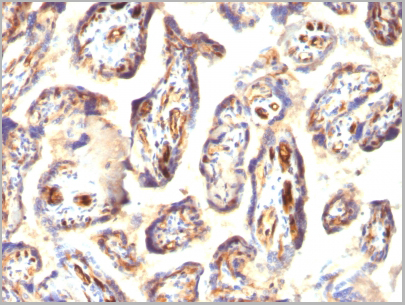 product-image-AAA13811_IHC2.jpg