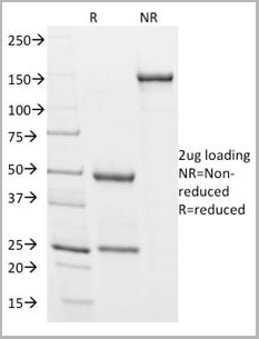product-image-AAA13811_SDS_PAGE6.jpg