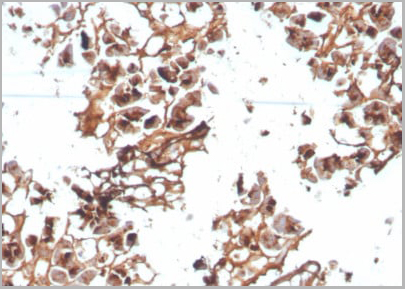 product-image-AAA13812_IHC.jpg