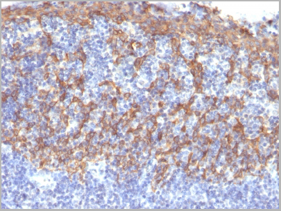 product-image-AAA13813_IHC.jpg