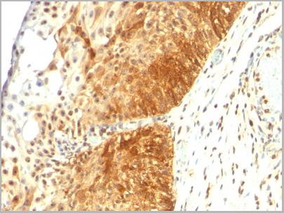 product-image-AAA13813_IHC2.jpg