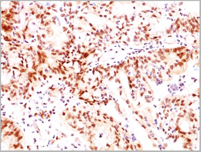 product-image-AAA13814_IHC2.jpg