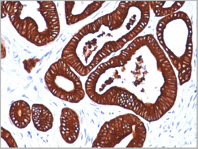 product-image-AAA13816_IHC.jpg