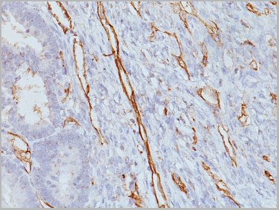 product-image-AAA13818_IHC3.jpg