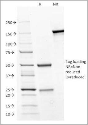 product-image-AAA13818_SDS_PAGE2.jpg