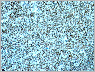 product-image-AAA13823_IHC2.jpg