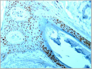product-image-AAA13823_IHC4.jpg