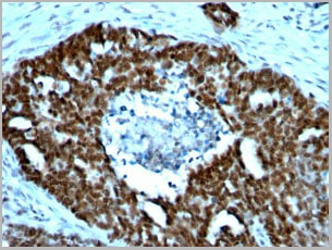 product-image-AAA13823_IHC6.jpg