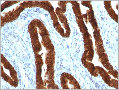 product-image-AAA13824_IHC.jpg