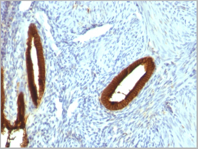 product-image-AAA13824_IHC2.jpg