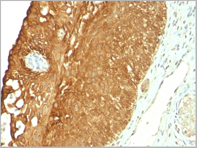 product-image-AAA13824_IHC3.jpg