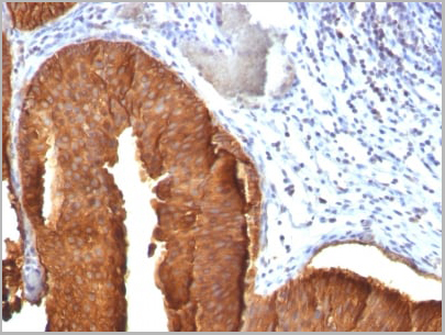 product-image-AAA13824_IHC4.jpg