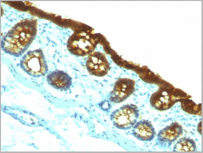 product-image-AAA13824_IHC6.jpg