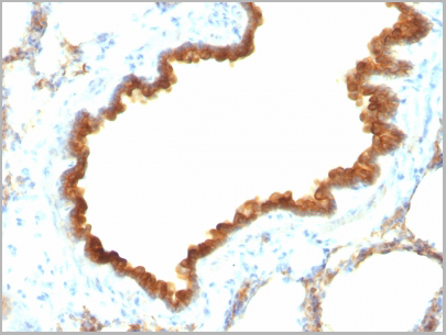 product-image-AAA13824_IHC7.jpg