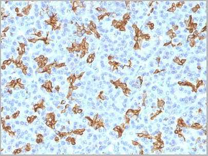 product-image-AAA13824_IHC8.jpg