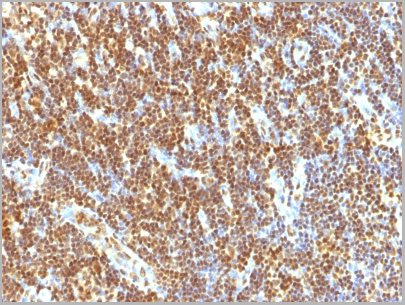 product-image-AAA13825_IHC.jpg