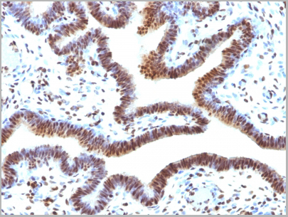 product-image-AAA13825_IHC3.jpg
