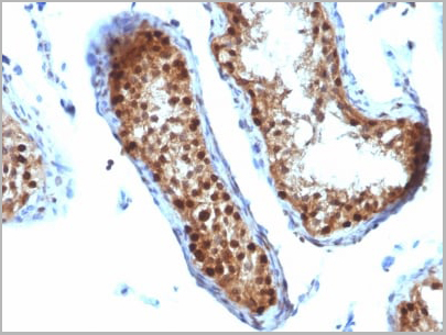product-image-AAA13825_IHC4.jpg