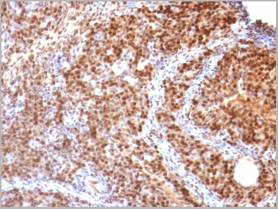product-image-AAA13825_IHC5.jpg