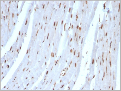 product-image-AAA13825_IHC6.jpg