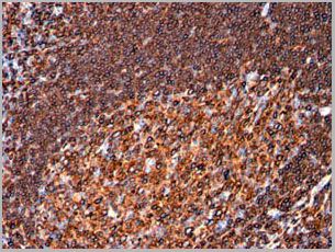 product-image-AAA13826_IHC3.jpg