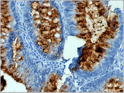 product-image-AAA13833_IHC.jpg
