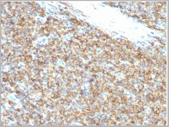 product-image-AAA13840_IHC2.jpg