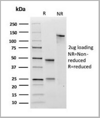 product-image-AAA13840_SDS_PAGE.jpg