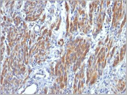 product-image-AAA13842_IHC.jpg