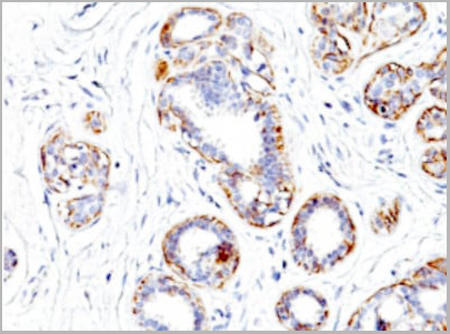 product-image-AAA13842_IHC2.jpg