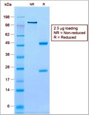 product-image-AAA13848_SDS_PAGE2.jpg