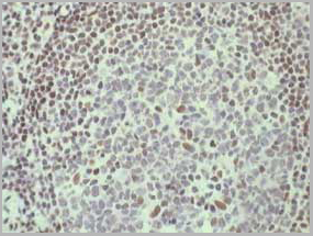 product-image-AAA13850_IHC.jpg
