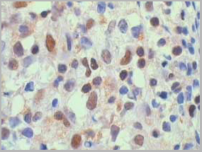 product-image-AAA13851_IHC.jpg